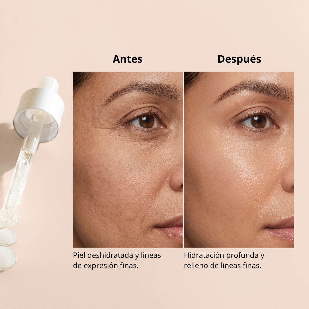 Hyaluronic Serum | Hidratación Profunda y disminuye líneas de expresión