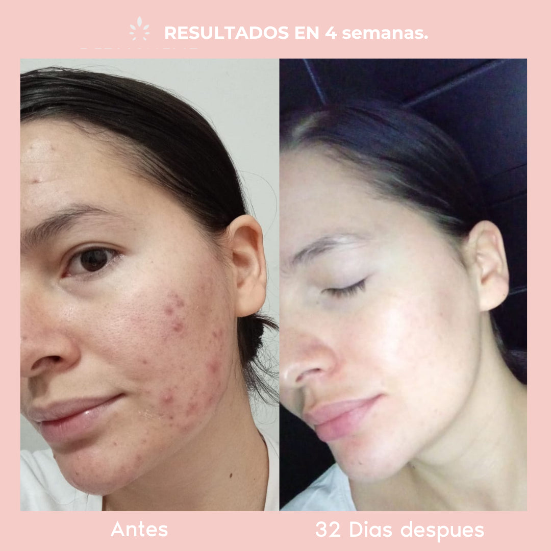 Serum Extra Aclarante | Corrige Manchas, Brotes y Tono Uniforme